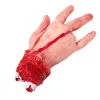 Amputierte Rechte Hand